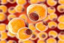 سرانجام ، چربی بدن بعد از کاهش وزن