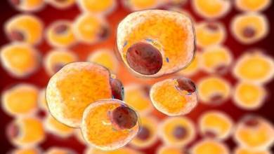 سرانجام ، چربی بدن بعد از کاهش وزن