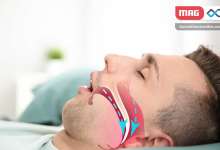 افسردگی تنفسی