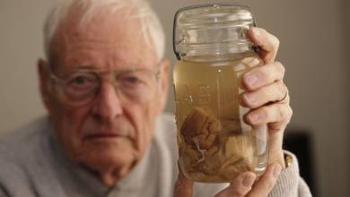 مغز انیشتین الان کجاست؟