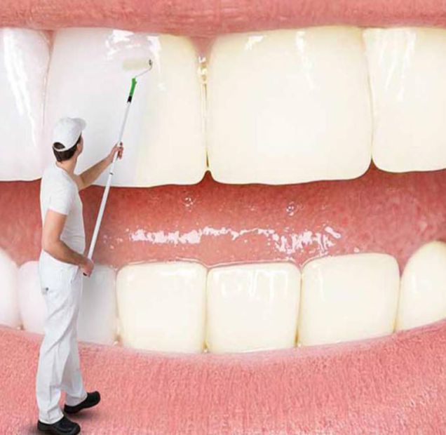برای سفیدی دندان ها چه کار هایی باید انجام داد؟