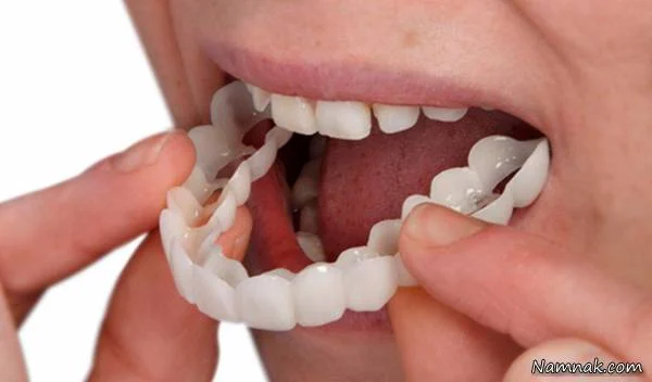 برای جا افتادن دندان مصنوعی چه کنیم؟
