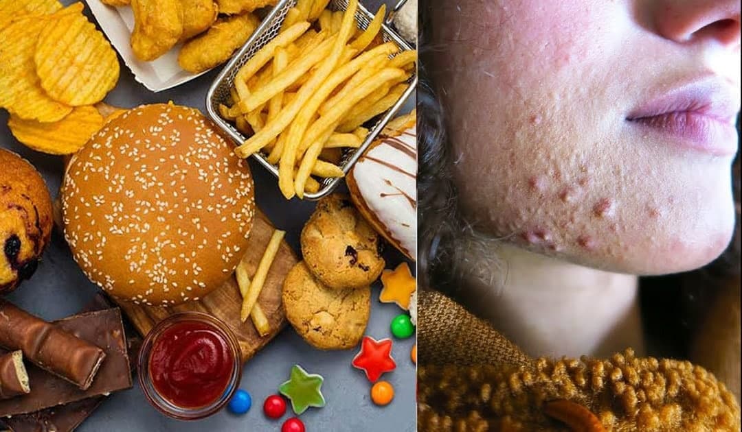 چرا قهوه میخورم جوش میزنم