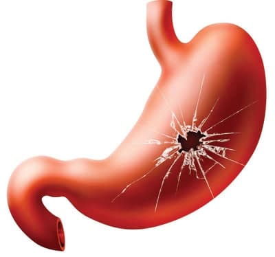 نسخه طلایی دکتر خیراندیش برای معده