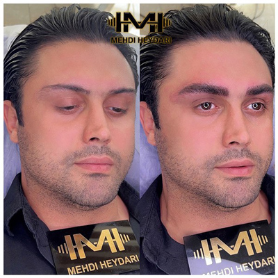 برای میکروبلیدینگ آقایان در تهران کجا بریم ؟