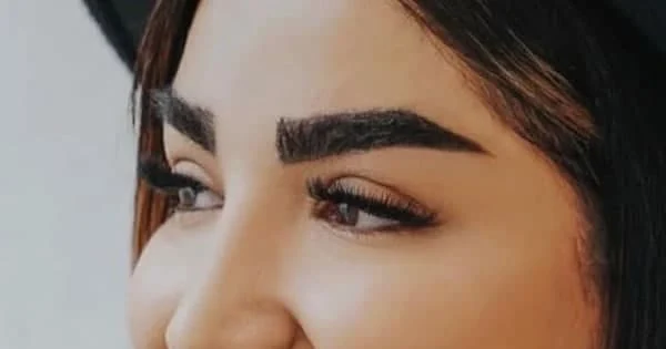 بهترین پزشک کاشت ابرو در تهران