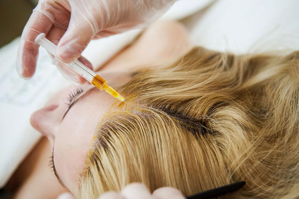 The best vitamin pills to treat severe hair loss