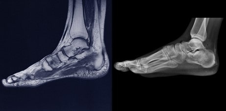 What causes foot pain