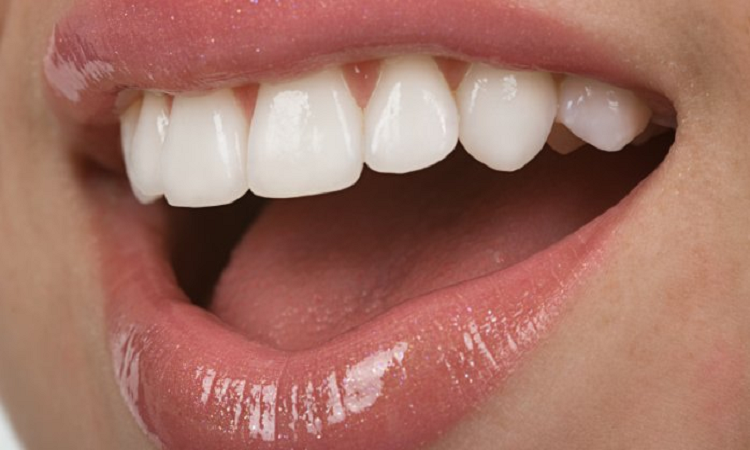 How to treat tooth decay