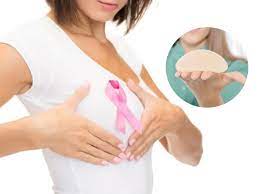 ماندگاری پروتز سینه به چی بستگی دارد