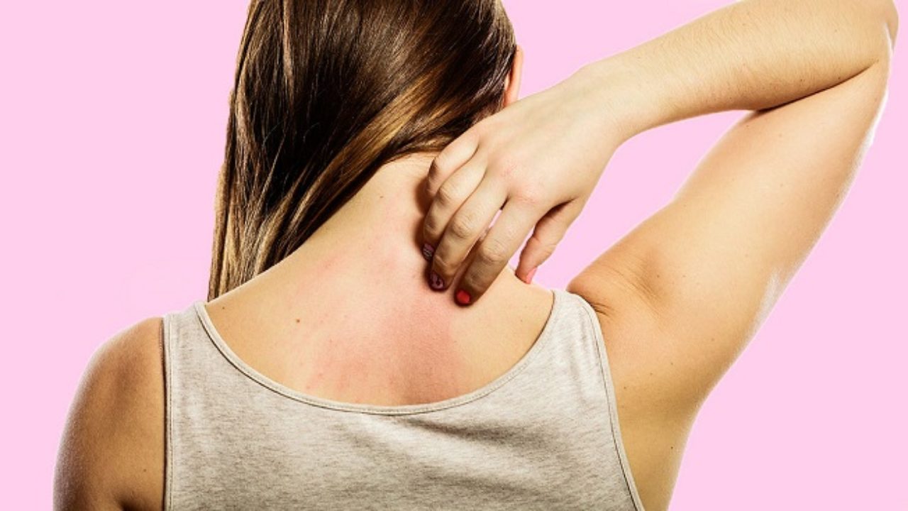 درمان‌های خانگی خارش بدن