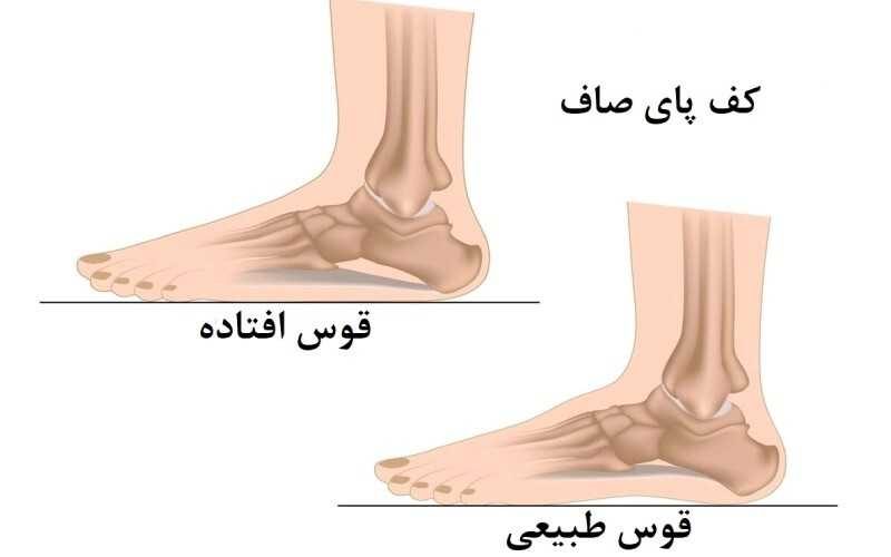 انواع بیماری‌های مربوط پا