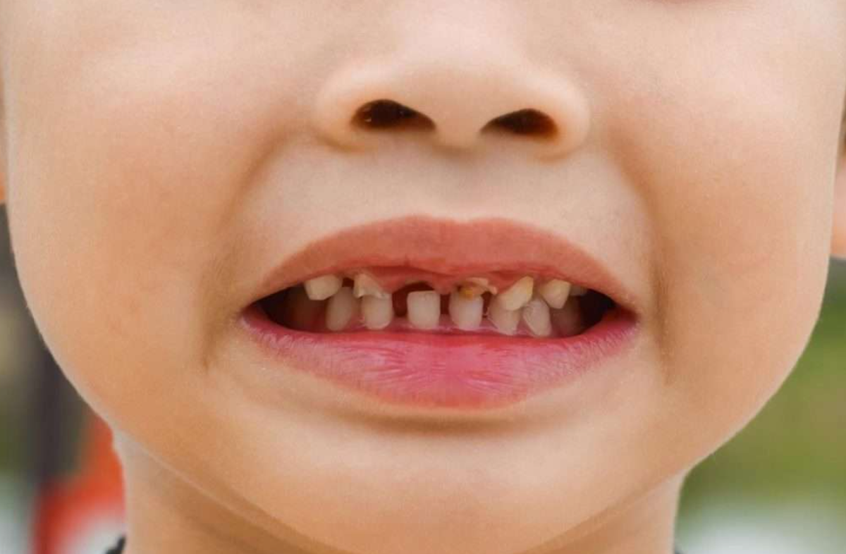 قاتلان خاموش دندان شیری؛ از شیر شب تا شکلات چسبنده!