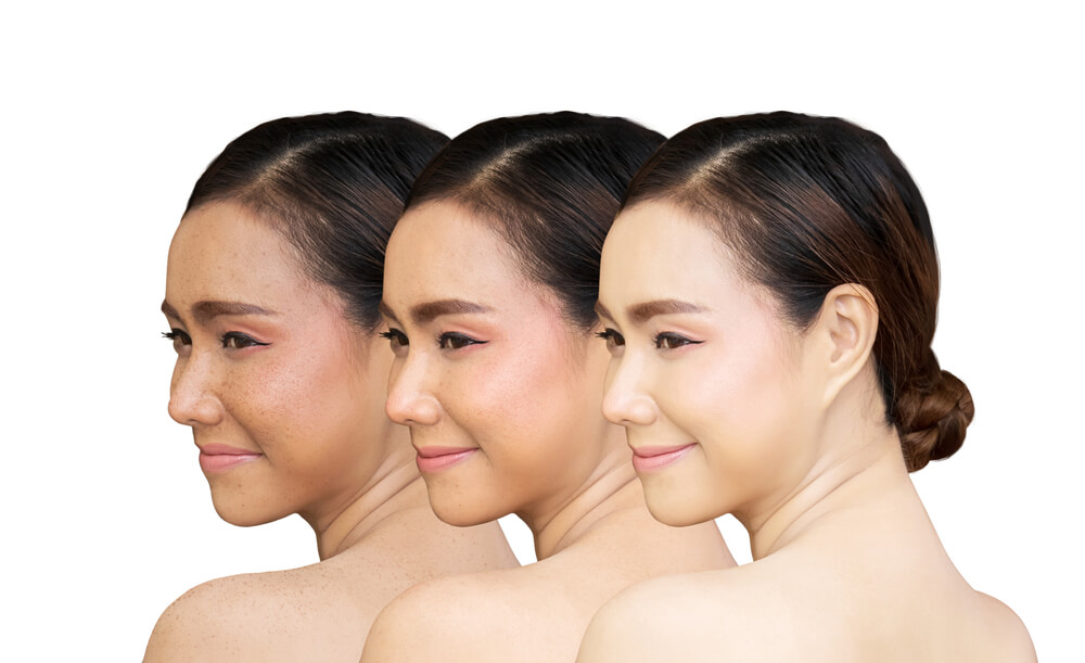 تجربه مصرف قرص گلوتاتیون گلوتانکس کره ای: بررسی علمی و نتایج واقعی بر پوست